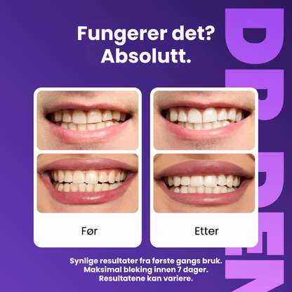 Eulary™ Lilla Tannblekingsstrips