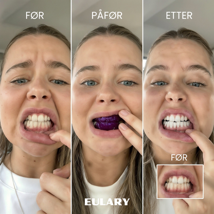 Eulary™ Lilla Tannblekingsstrips